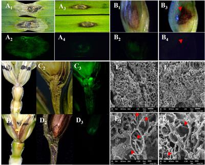 The Black Necrotic Lesion Enhanced Fusarium graminearum Resistance in Wheat